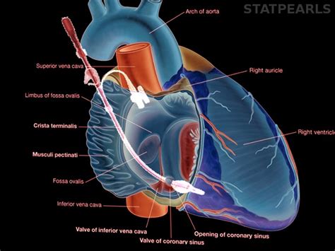 Anatomy, Thorax, Coronary Sinus Article - StatPearls