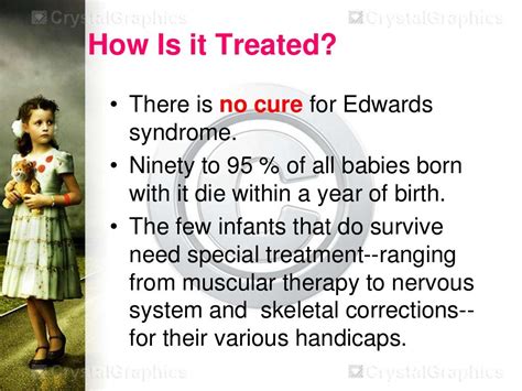 EDWARD SYNDROME