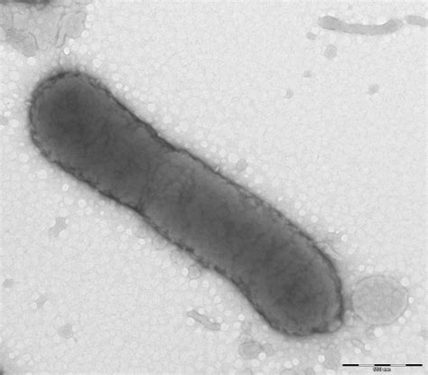 Non-contiguous finished genome sequence of Prevotella timonensis type strain 4401737T ...