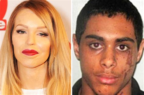 Thug who threw acid at Katie Piper applies for parole | Daily Star