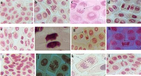 Anaphase Stages