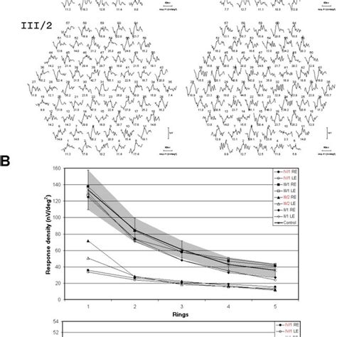 Multifocal electroretinography results of the two patients, carriers,... | Download Scientific ...