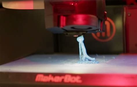 Young Girl Breathes Easier with Help from 3D Printed Trachea | 3DPrint ...