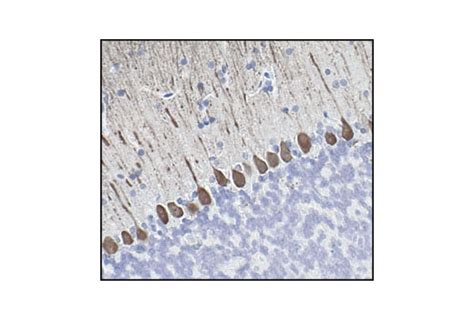 Calbindin Antibody | Cell Signaling Technology