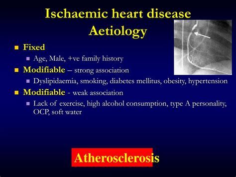 PPT - Ischaemic Heart Disease Clinical Aspects For DENTIST PowerPoint Presentation - ID:5169453