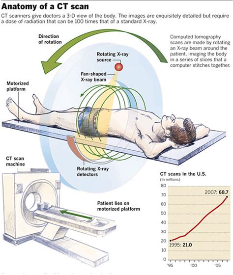 Computerised Tomography (CT) Scan