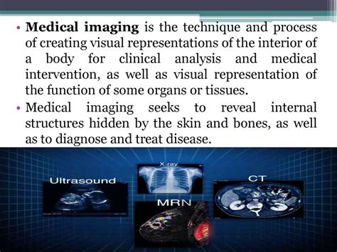 Type of Imaging Modalities In Radiology - презентация онлайн