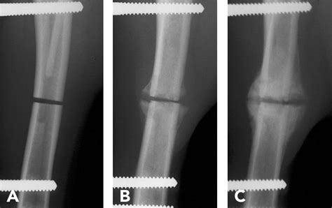 A Practitioner’s Guide to Fracture Management, Part 2: Selection of ...