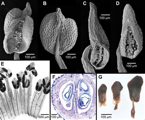 Stamen structure and anatomy of Humiriaceae. AVantanea compacta anther,... | Download Scientific ...