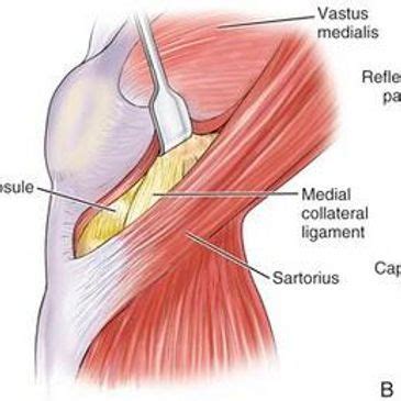 Jiffy Knee Simplified | Jiffy Knee