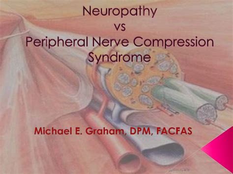 Peripheral Nerve Compression Syndrome