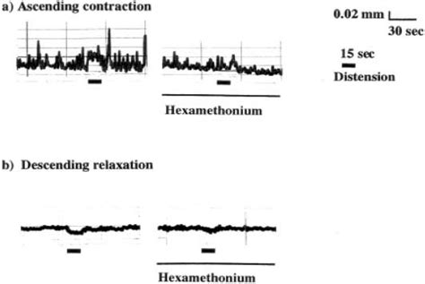 Effects of hexamethonium on ascending contraction and descending... | Download Scientific Diagram