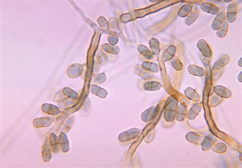 Public Domain Picture | This photomicrograph shows conidia-laden conidiophores of the fungus ...