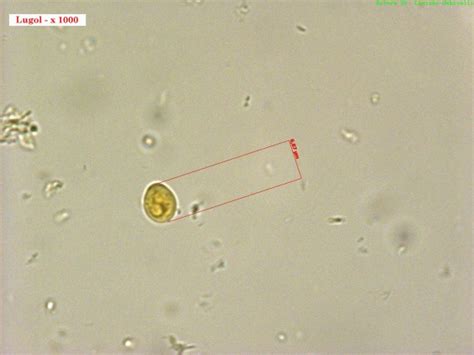 Chilomastix mesnili | Medical Laboratories