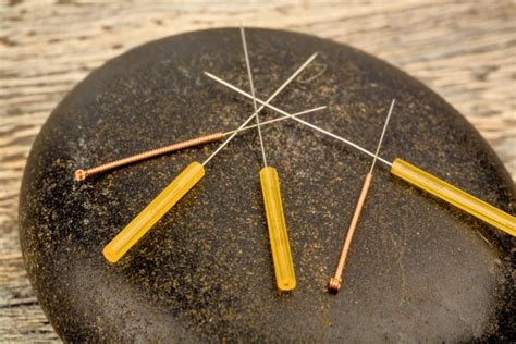 Acupuncture needles Stock Photo by ©ginasanders 58527273