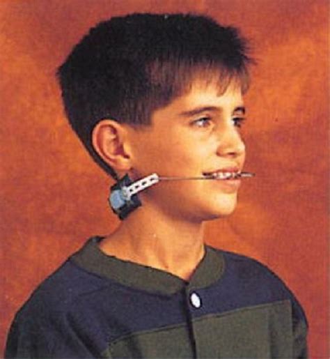 Orthodontist Won’t Let Kid Remove Headgear For School Photo | Headgear, Dental braces, Brace face