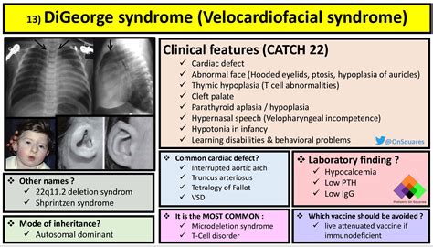 Velocardiofacial Syndrome