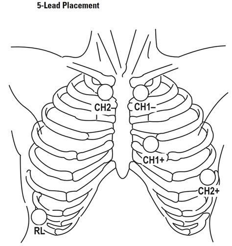 Holter monitor uses, instructions, preparations and Holter monitor results