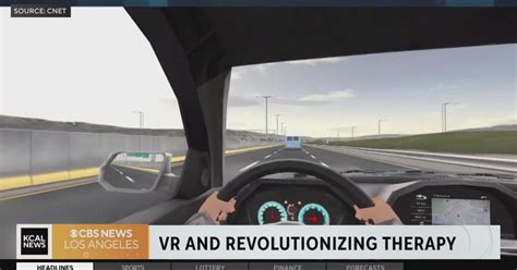 How virtual reality is revolutionizing therapy - CBS Los Angeles