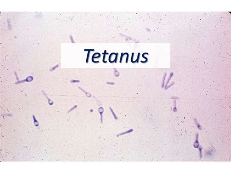 Tetanus