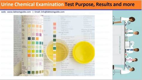 Urine Urobilinogen Test Purpose, - Lab Tests Guide