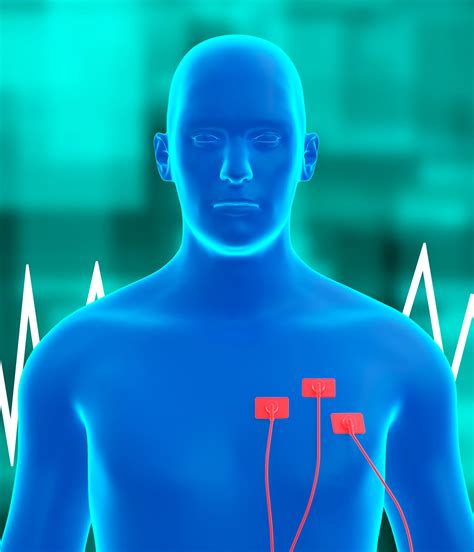 Holter Monitor - Edmonton Echolab