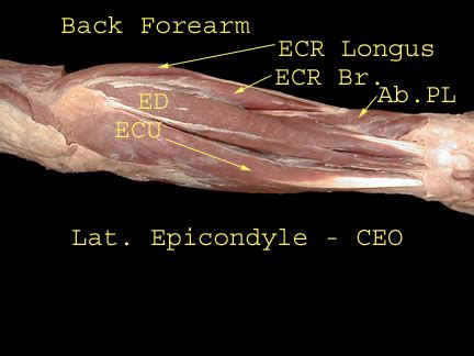 059_ForearmRadial_1_288