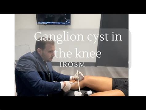 What is a ganglion cyst in the knee? - YouTube