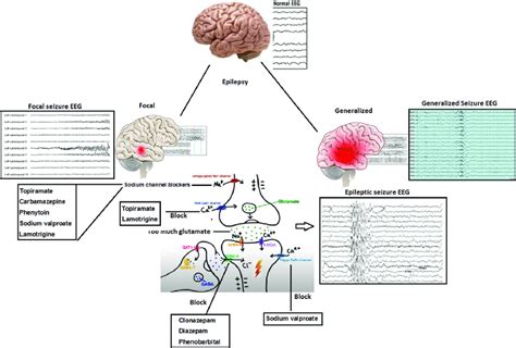 Different mechanisms of AEDs action. | Download Scientific Diagram