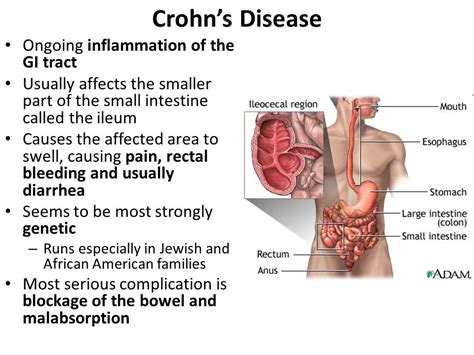 Diseases of gi tract. Digestive Diseases: Comprehensive Summary and ...