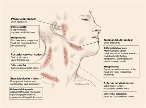 Lymphadenopathy - Cancer Therapy Advisor