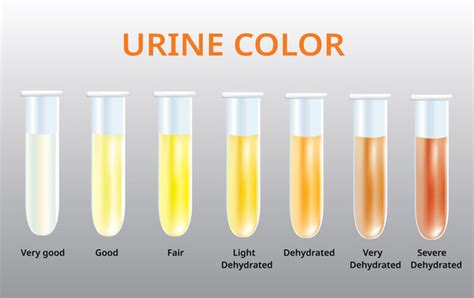 4,141 BEST Urine Color IMAGES, STOCK PHOTOS & VECTORS | Adobe Stock