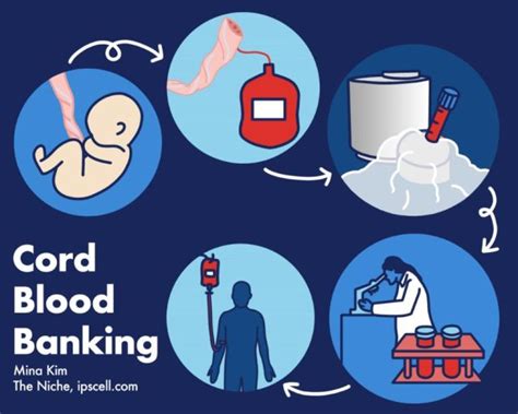 Fact-checking, pros and cons of cord blood banking - The Niche