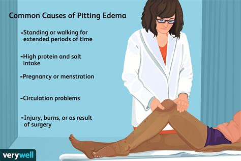 Pitting Edema: What It Is, Symptoms, & Treatments