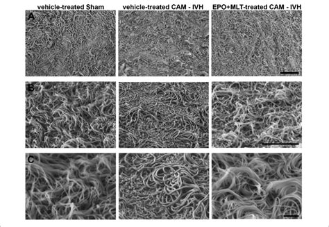 | Scanning electron microscopy (SEM) images of P21 ependymal motile ...