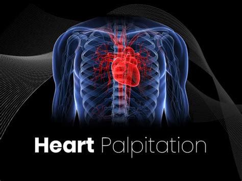 Heart Palpitations: Causes, Symptoms, Risk Factors And Treatment ...