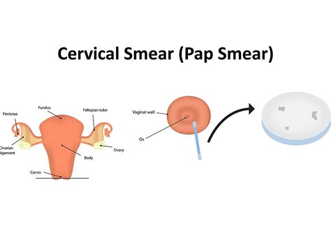 Pap Smear Test during Pregnancy: Need, Safety & Risks Associated