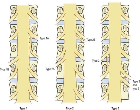 Nerves of the lumbar spine | Clinical Gate