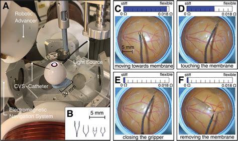 Robotic epiretinal membrane peeling surgery in an eye phantom A) Setup ...