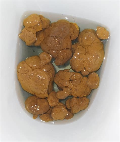 Big constipated nuggets : r/poop