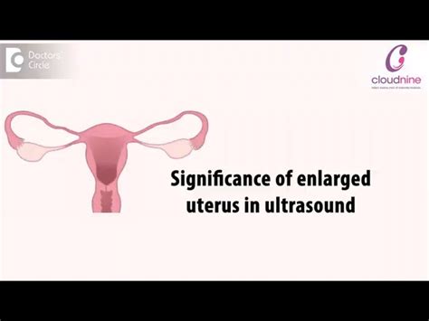 What Causes A Enlarged Uterus