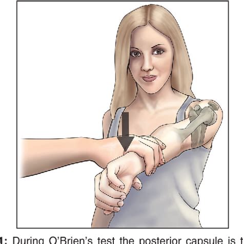 Table 1 from Reinterpretation of O'Brien test in posterior labral tears of the shoulder ...