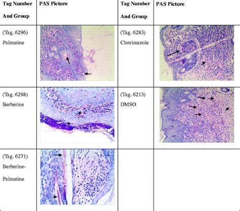 Photographs Of Skin Histology After Pas Staining Red Spots Represent | Images and Photos finder