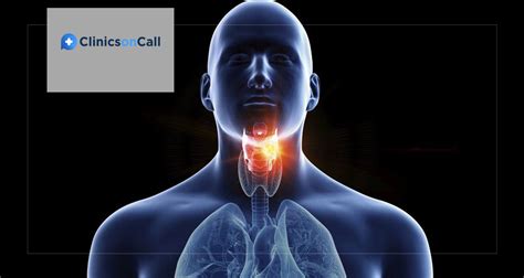 Tonsil cancer symptoms, diagnosis, and treatment abroad - Clinics on Call