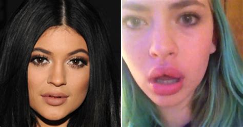 Experts: 'Kylie Jenner Lip Challenge' Is Dangerous And Damaging - CBS ...