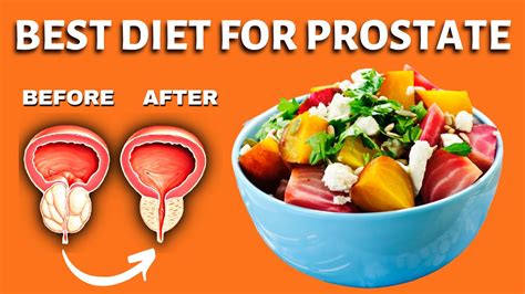 What Food to Eat & Avoid for Prostate Problems #prostatehealth #diet #food - YouTube