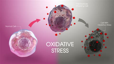 Oxidative Stress: Effects, Risk factors, Managing and Preventing - Scientific Animations