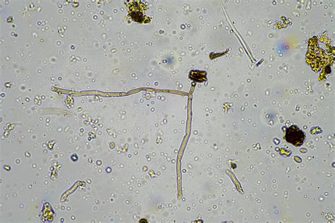 Microbial Testing - Prism Triangle LLC