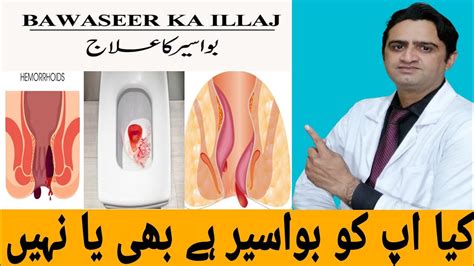 Bawaseer Ka Ilaj, How To Get Rid of Piles, Hemorrhoids: Causes Symptoms Treatment, Bawasir Men ...