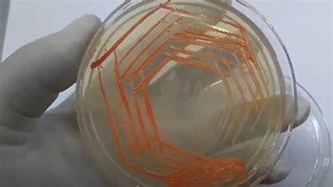 Micrococcus roseus-Introduction, Morphology, Pathogenicity, Lab